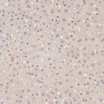 YAP1 Rabbit Polyclonal Antibody