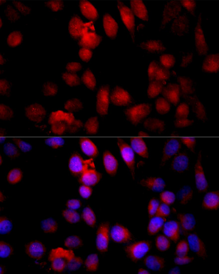 Caspase3 Polyclonal Antibody