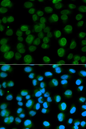 EMD Antibody