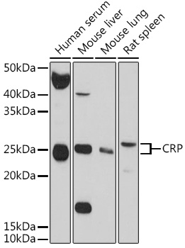 CRP Antibody