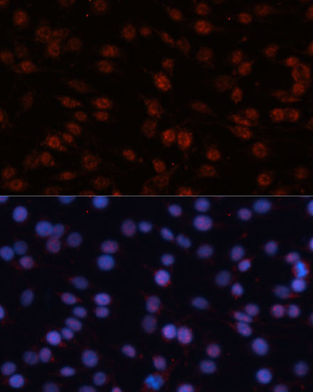 TCF4 Antibody