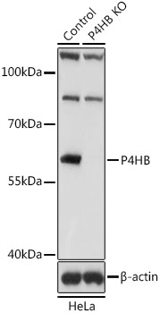 P4HB Antibody