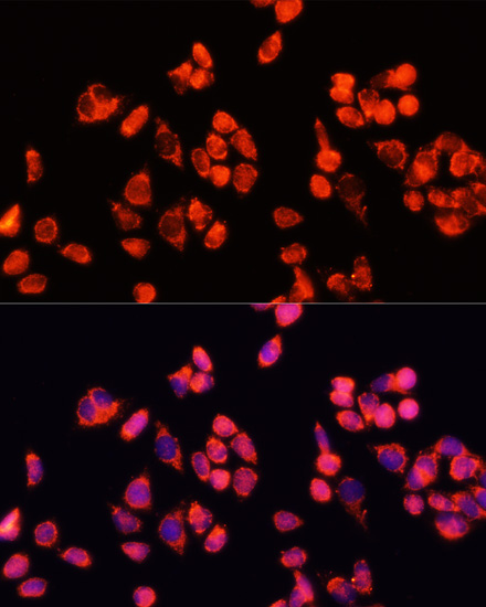 ANGPT2 Antibody