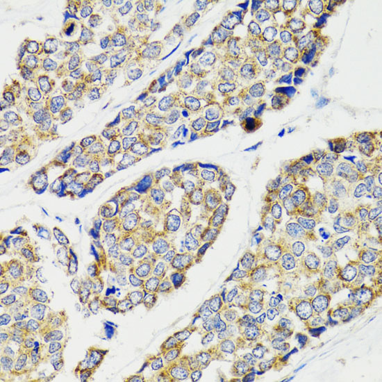 IKBKG Antibody