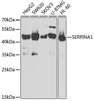 SERPINA1 Antibody