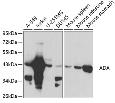 ADA Antibody