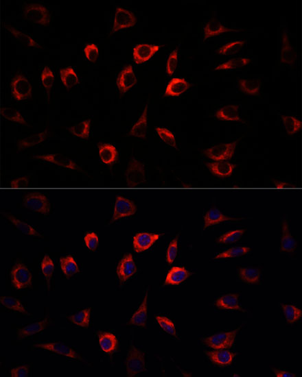 SGK1 Antibody