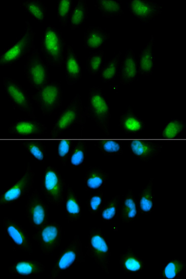 CBX5 Antibody