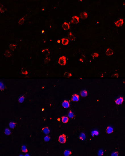 IL1B Antibody