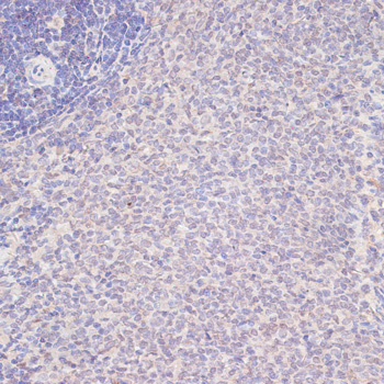 YAP1 Rabbit Polyclonal Antibody