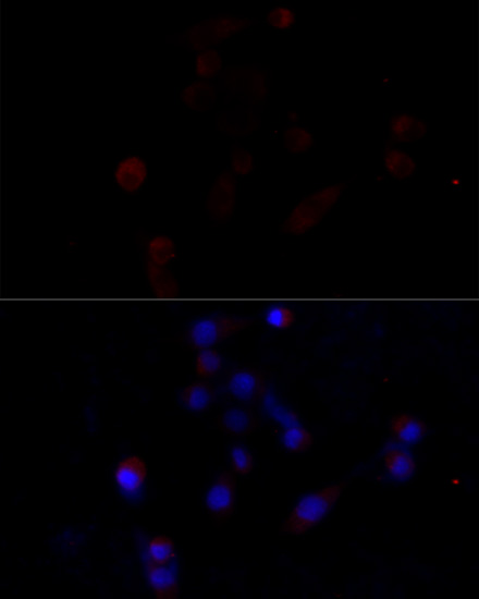 Caspase3 Polyclonal Antibody