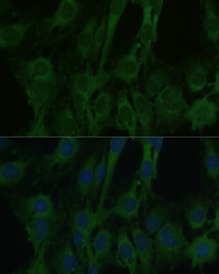 FABP7 antibody