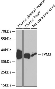 TPM3 Antibody