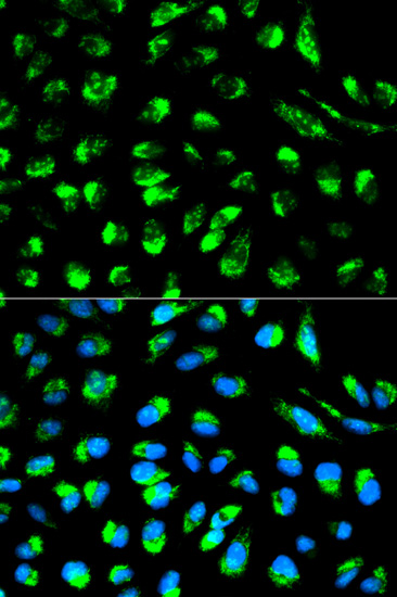 ECI1 Antibody