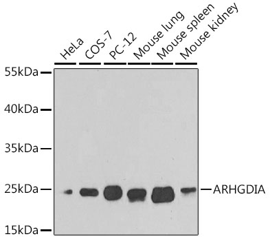 ARHGDIA Antibody