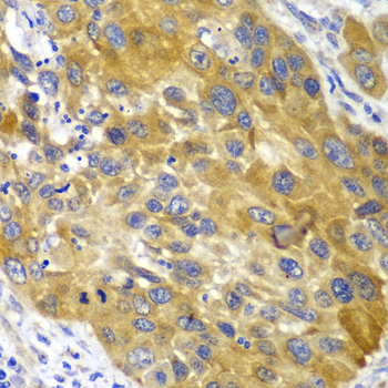 AK1 Antibody