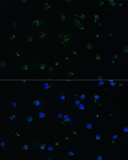 ARHGAP25 Antibody