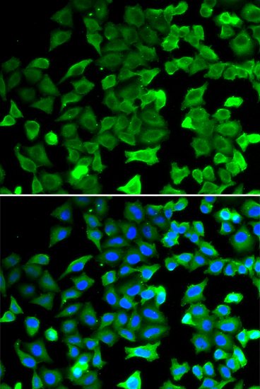 SIRT2 Antibody