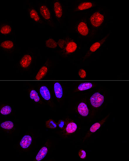 ATXN3 Antibody