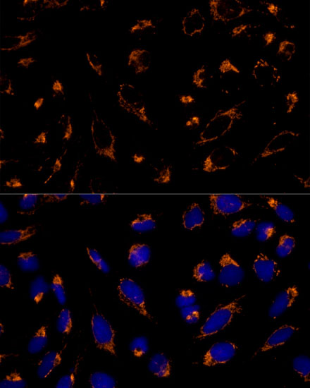 PRDX3 antibody