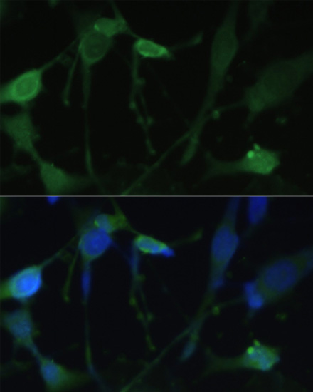 FABP7 antibody