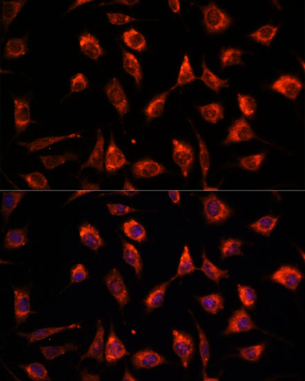 TPT1 Antibody