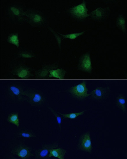 VCP antibody