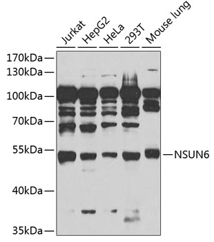 NSUN6 Polyclonal Antibody