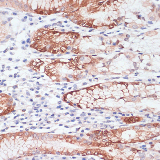 LYZ Polyclonal Antibody