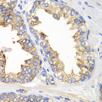 KLK10 antibody