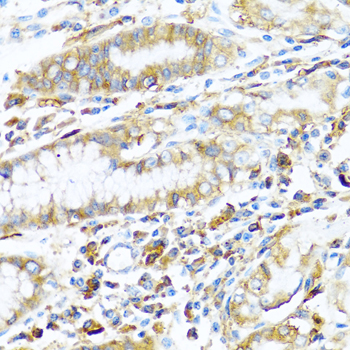 HLA-DPB1 Antibody