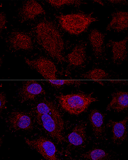 RPL21 Polyclonal Antibody