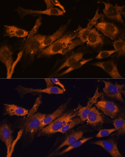 RPL36AL Polyclonal Antibody