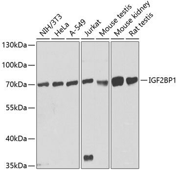 IGF2BP1 Antibody