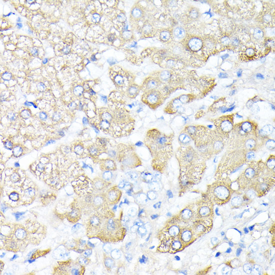 HP Antibody