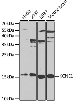 KCNE1 Antibody