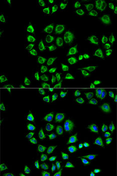 CD1D Antibody