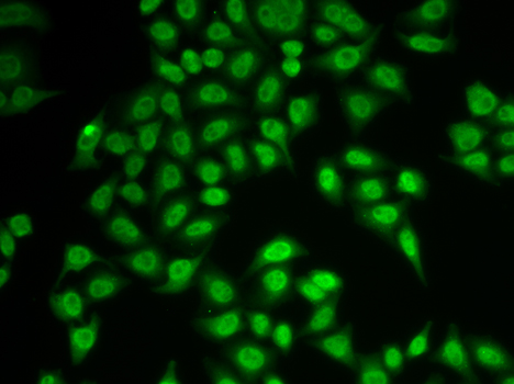 PSMB9 Antibody