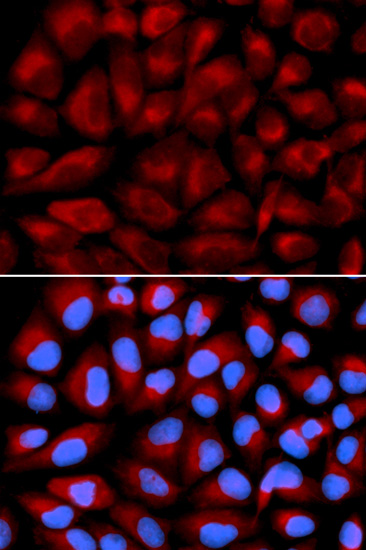 FANCC Antibody