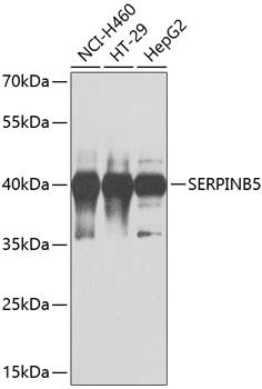 SERPINB5 Antibody