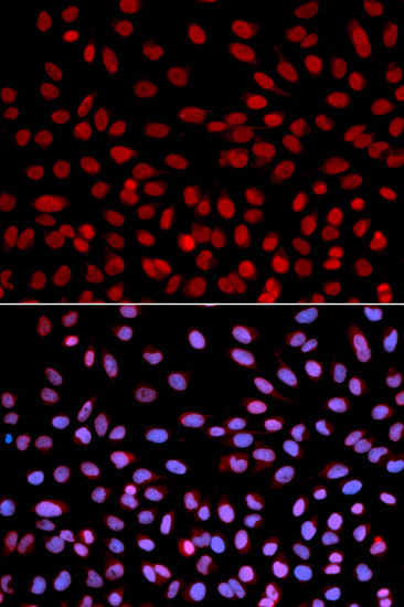 POLH Antibody