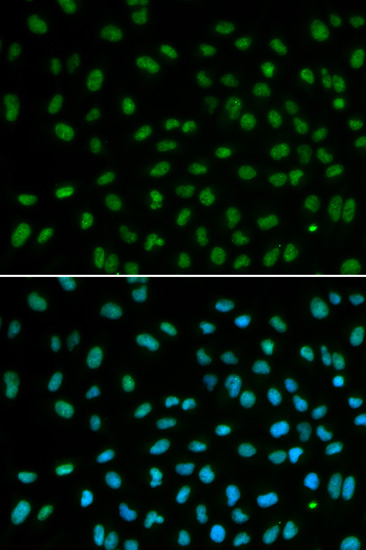 DDB2 Antibody