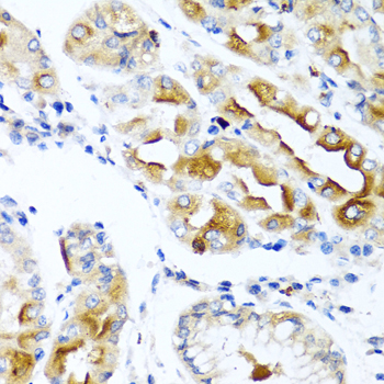 CCL21 antibody