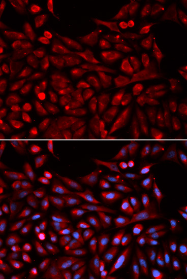 NR1I3 Antibody