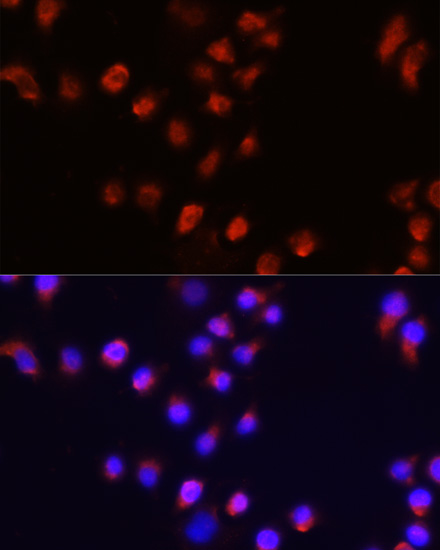 ACVR2A antibody