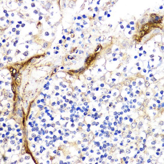 BMPR1B Antibody