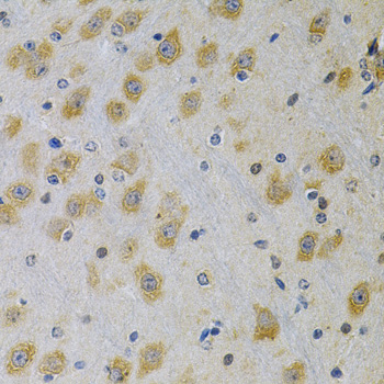 IGFBP4 antibody