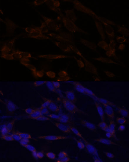 CHUK Antibody