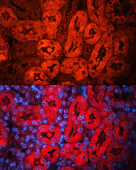 LCN2 antibody