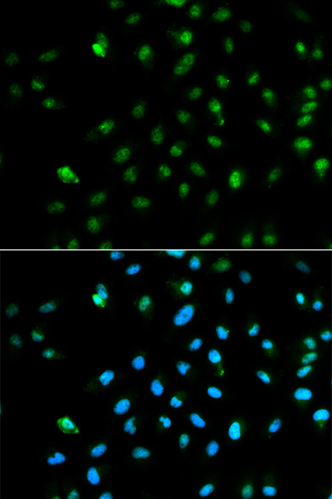 POLR2A Antibody